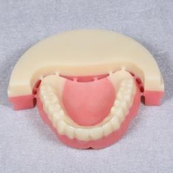 PMMA Multilayer Full Denture